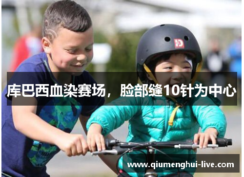 库巴西血染赛场,脸部缝10针为中心 库巴西血染赛场,脸部缝10针为中心